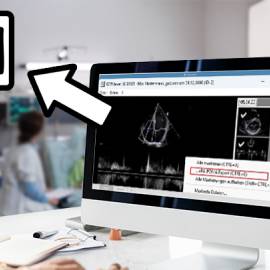 Zusammen mit unserem Partner sonoGDT machen wir Ihre Ultraschallbilder für die ePA verfügbar
